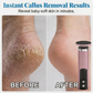 Multi-Function Electric Foot Grinder with 5 Speeds