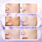 🎉2025 Nieuwe Verbetering🎉Alles-in-één Niacinamide Crème