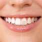 5 ml Instant Whitening Tandverf