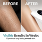 Professioneel IPL laser ontharingsapparaat